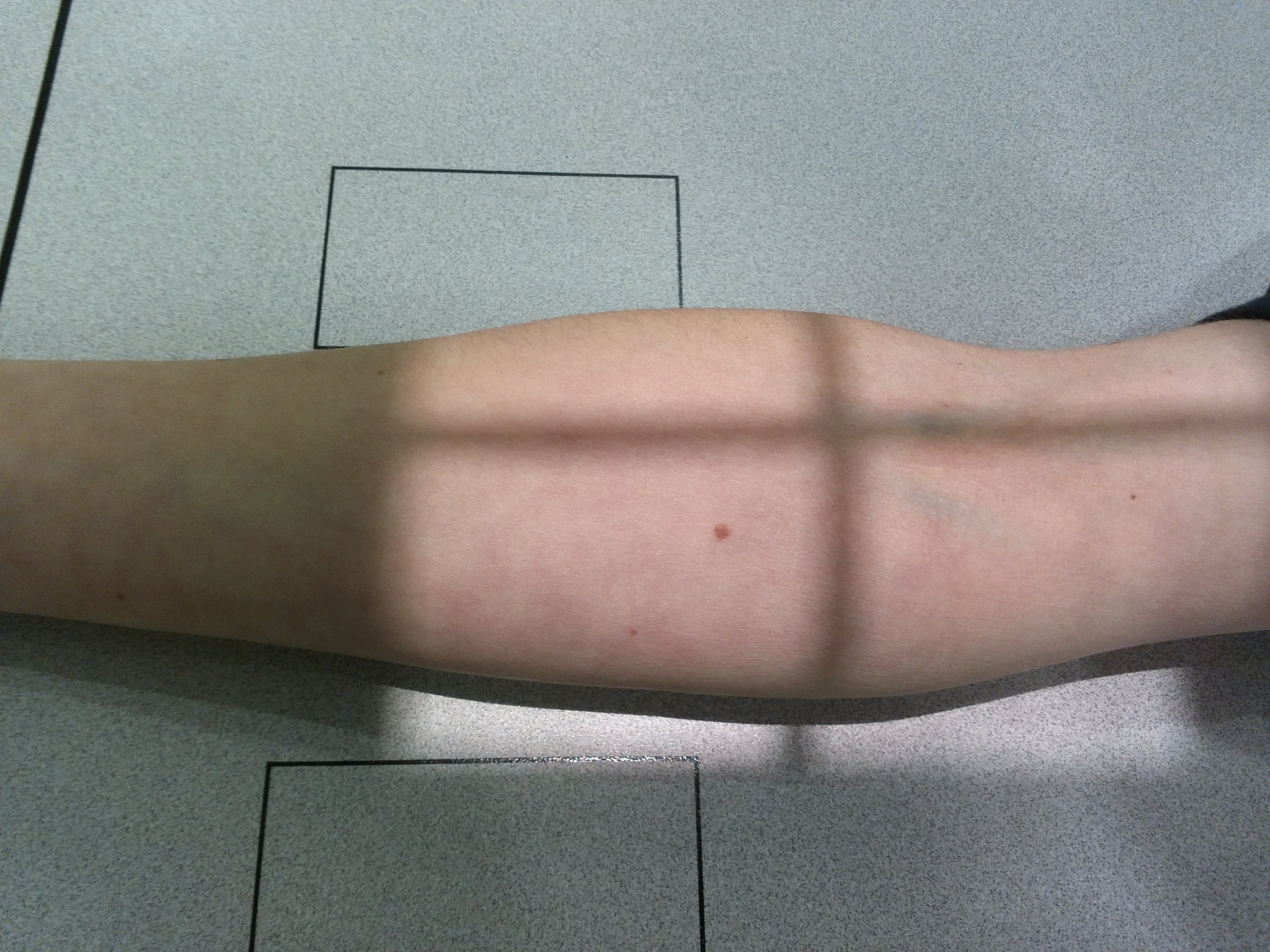 AP Elbow Radiography